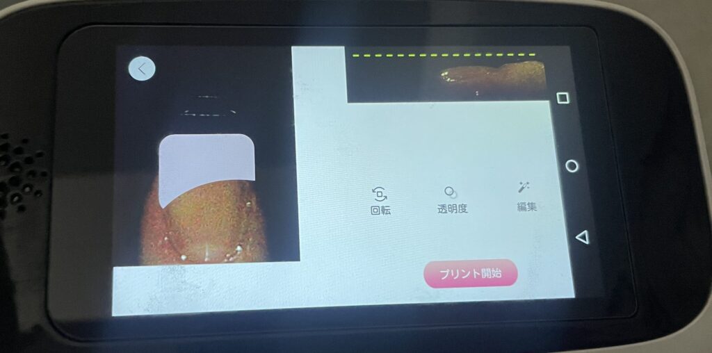 ネイルプリンター1ネイルプリント位置調整