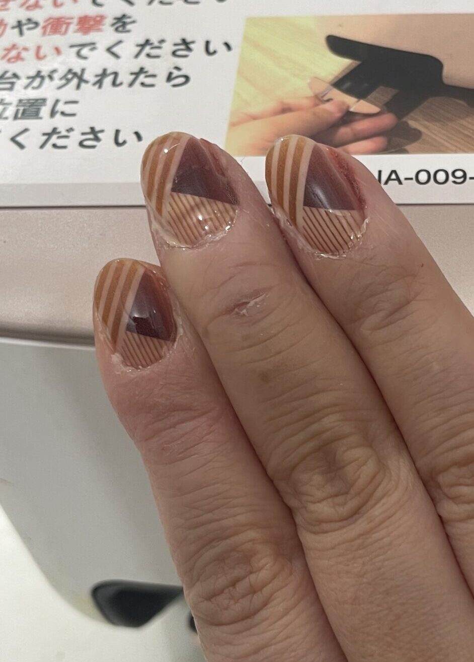 チョコザップセルフネイルの仕上がり・成功例